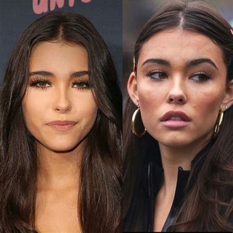 madison beer plastic sugery|Madison Beer shows “proof” she didn’t have plastic surgery after。